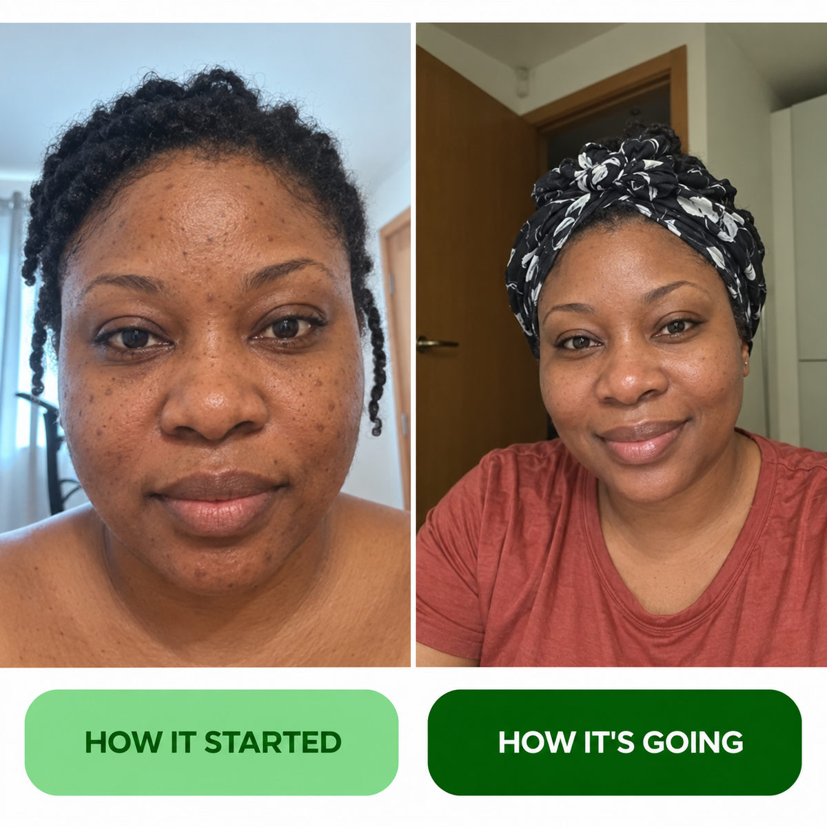 Nirvano Turmeric Fade & Glow Bar — real customer results, unretouched