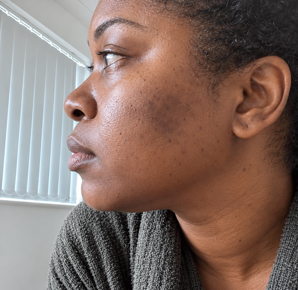 Before using Nirvano Turmeric Soap